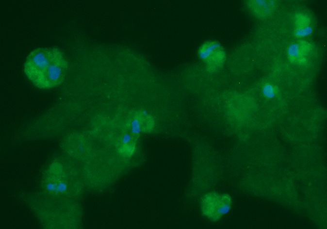 Human CK1 alpha Antibody (FITC Conjugate)
