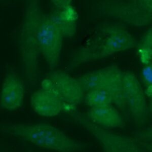 Human Carbonic Anhydrase 14 (CA14) Antibody (FITC Conjugate)