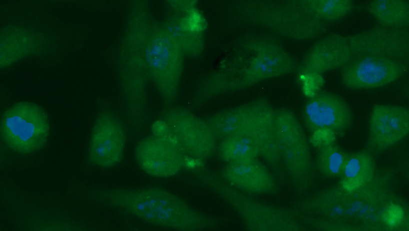 Human Carbonic Anhydrase 14 (CA14) Antibody (FITC Conjugate)
