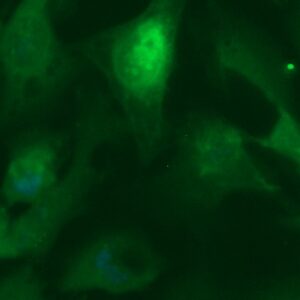 Human Aurora Kinase B (AURKB) Antibody (FITC Conjugate)