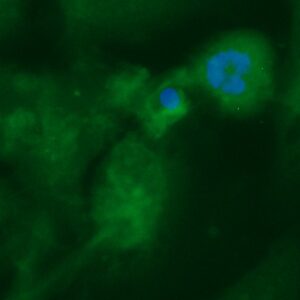 Human Acyl-CoA Thioesterase 11 (ACOT11) Antibody (FITC Conjugate)