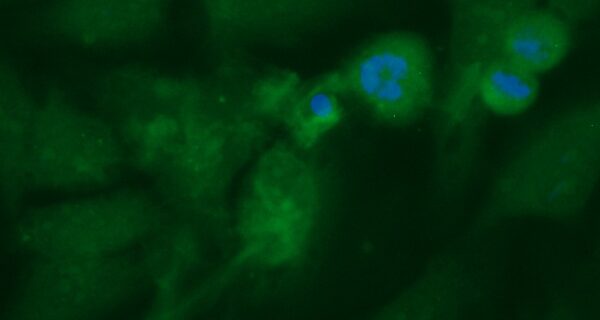 Human Acyl-CoA Thioesterase 11 (ACOT11) Antibody (FITC Conjugate)