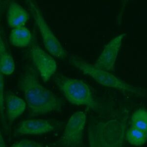 Human Coproporphyrinogen Oxidase (CPOX) Antibody (FITC Conjugate)