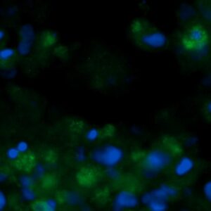 Human DUSP26 Antibody (FITC Conjugate)