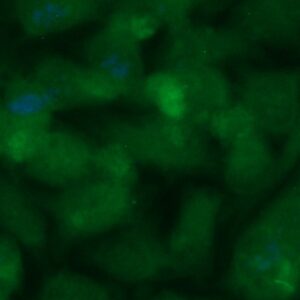 Human Calreticulin-3 (CALR3) Antibody (FITC Conjugate)