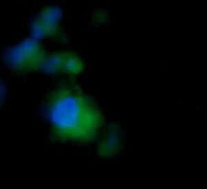 Human FGFR2 Antibody (FITC Conjugate)
