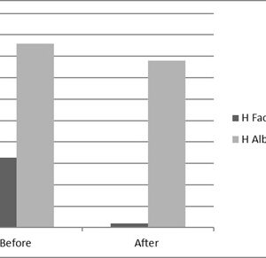 Human Factor V  (Factor 5) Deficient Plasma (EDTA)