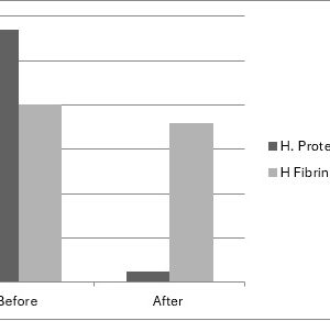Human Protein C Deficient Plasma  (EDTA)
