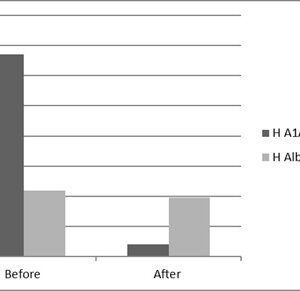 Human Alpha-1-Antitrypsin Deficient Plasma (EDTA)