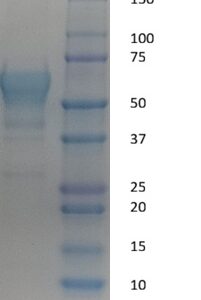 Human alpha-Fetoprotein (AFP)