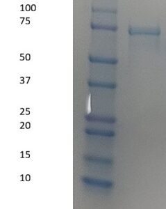 Human Factor XIIIa (Factor 13a)