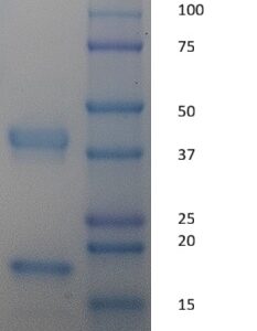 Human Haptoglobin, Phenotype 2-2