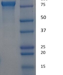 Human Plasminogen (PLG)