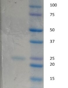 Human Apolipoprotein A-I (Apo A1)