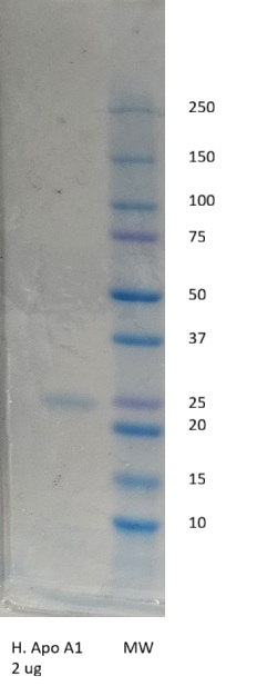 Human Apolipoprotein A-I (Apo A1)