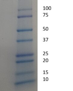 Human Apolipoprotein B (Apo B)