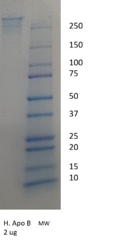 Human Apolipoprotein B (Apo B)