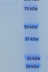 Human Complement Factor H