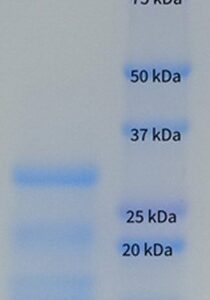 Human Factor VIIa (Activated Factor 7)