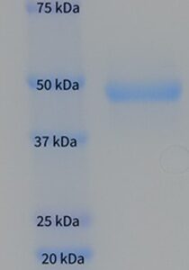 Human Gc-Globulin (Vitamin D-binding Protein, DBP)