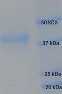 Human Haptoglobin (Mixed Type)