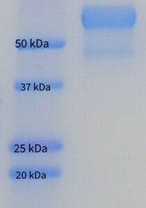 Human Hemopexin