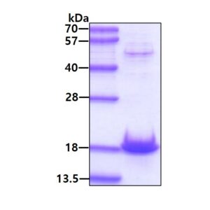 Human alpha-Synuclein (A30P)