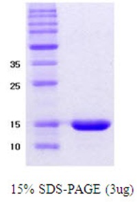 Human alpha-Synuclein (Delta-NAC)