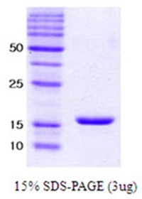 Human alpha-Synuclein E46K