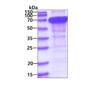 Human Cornulin (CRNN)
