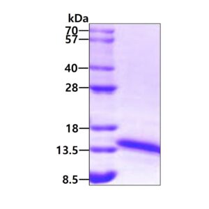 Human Ferredoxin 1 (FDX1)