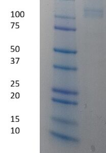 Human Inter Alpha Inhibitor Proteins (IAIP)