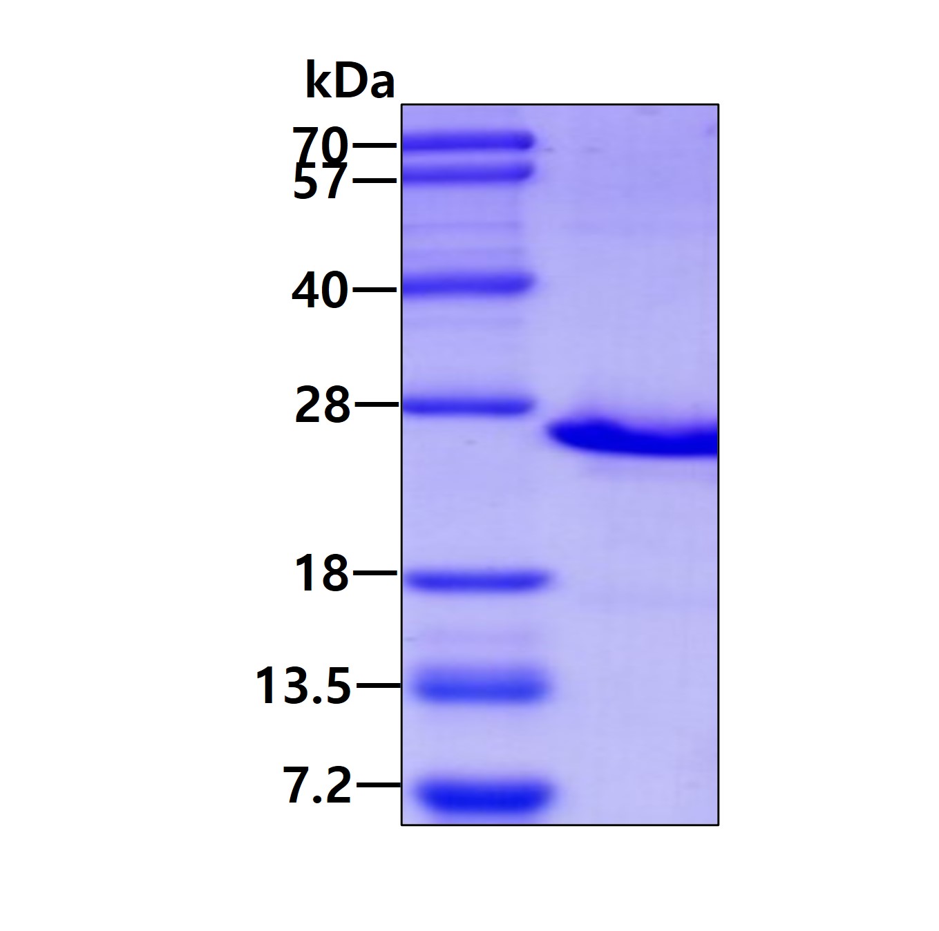 Human Podoplanin (PDPN)