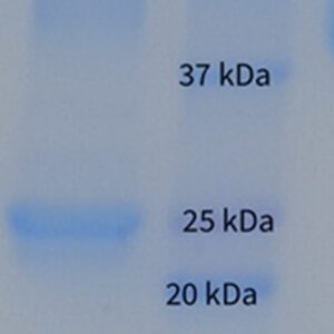 Human Immunoglobulin M (IgM)