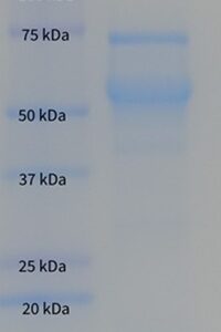Human Thyroxine-Binding Globulin (TBG)